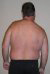 image of a back